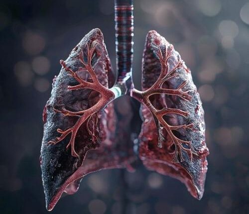 small cell lung cancer